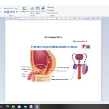 Иллюстрация №5: Особенности сестринского ухода за пациентом в послеоперационном периоде с аденомой предстательной железы (Дипломные работы - Хирургия).
